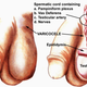 Illustration for article titled Pengobatan Varikokel Secara Tradisional